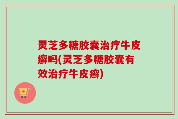 灵芝多糖胶囊治疗牛皮癣吗(灵芝多糖胶囊有效治疗牛皮癣)